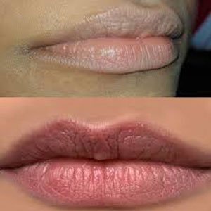 Permanent Lip color Treatment