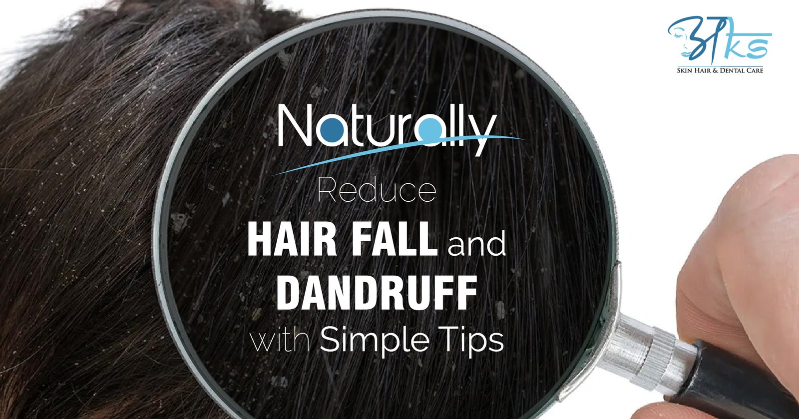 Naturally Reduce Hair Fall & Dandruff With Simple Tips
